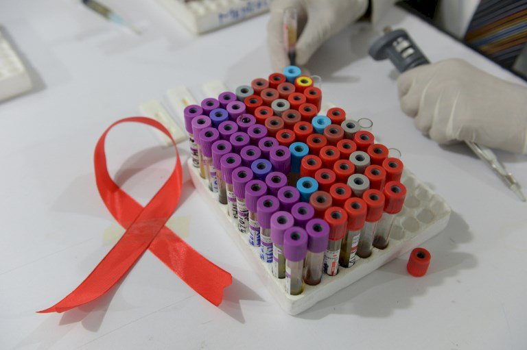 SIDA (illustration AFP)