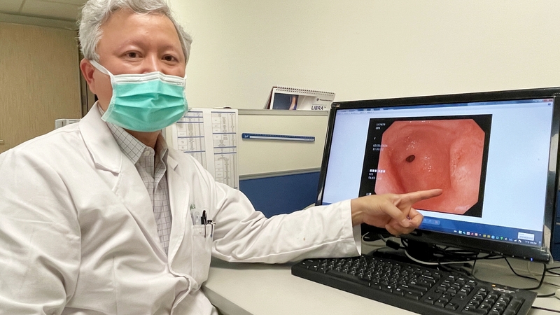 Le cancer de l'estomac est l'un des plus répandus à Taïwan (photo : CNA)