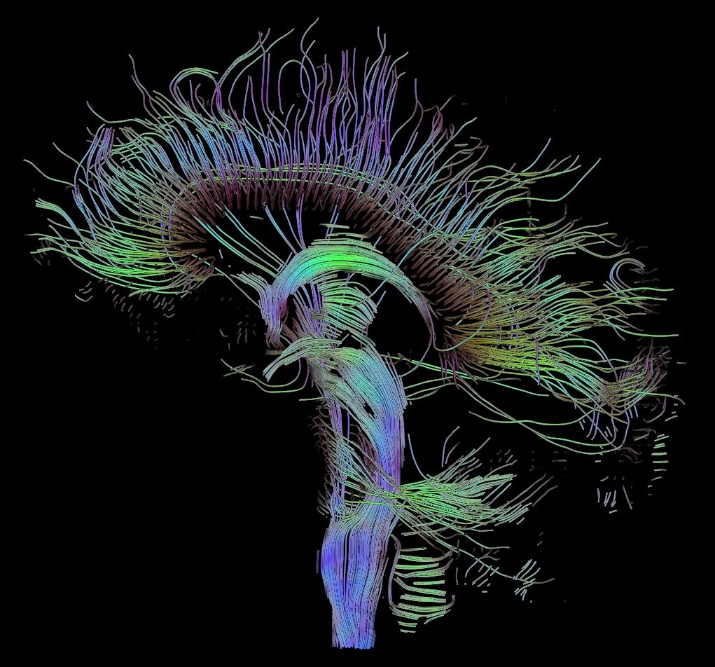 Données de l’imagerie du tenseur de diffusion (ITD) pour le cerveau (https://commons.wikimedia.org/wiki/File:DTI-sagittal-fibers.jpg#/media/File:DTI-sagittal-fibers.jpg)