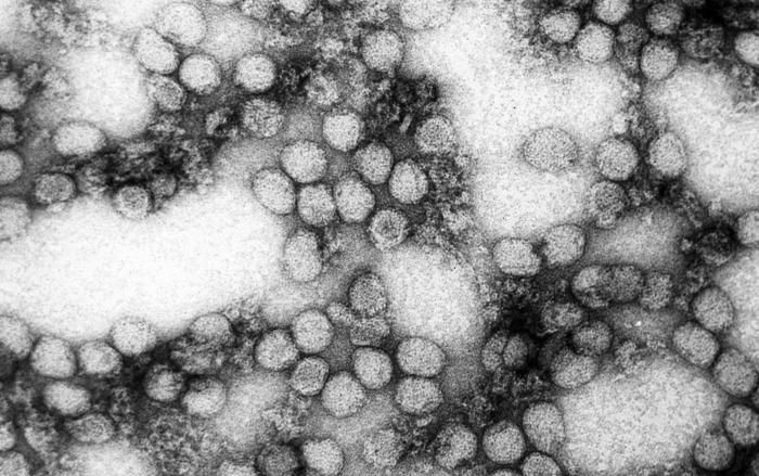 黃熱病病毒 (圖：取自維基百科)