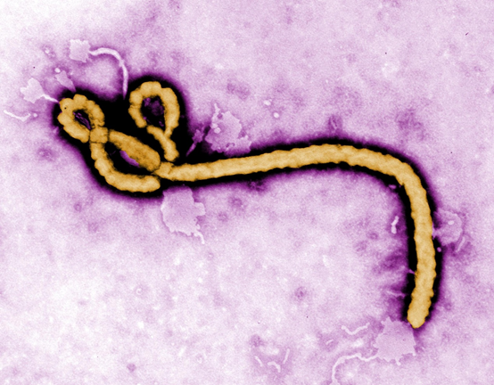 剛果民主共和國(民主剛果)的衛生部9日晚間表示，目前的伊波拉(Ebola)疫情是該國史上最嚴重的一次，目前共有319宗已證實與可能案例。圖為伊波拉病毒。(圖：取自美國疾病管制預防中心)