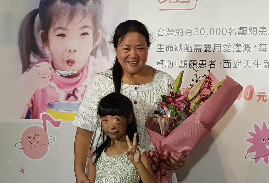 9歲的顱顏患童「唯唯」，歷經四次手術，逐漸修復外觀，加上有羅慧夫顱顏基金會的協助，讓「唯唯」能安心就醫、安心上學。(江昭倫 攝)