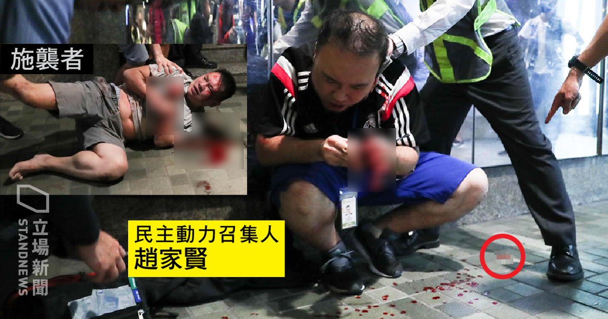 香港太古城西區議員、民主動力召集人趙家賢今晚遇襲，左耳被一名男子咬傷。(圖：取自立場新聞)