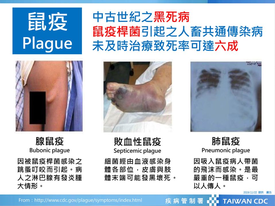鼠疫致病原為鼠疫桿菌，在鼠疫流行地區，民眾應避免被跳蚤叮咬或接觸病患。避免囓齒類動物進入住屋或接觸、處理其死屍。(疾管署提供)