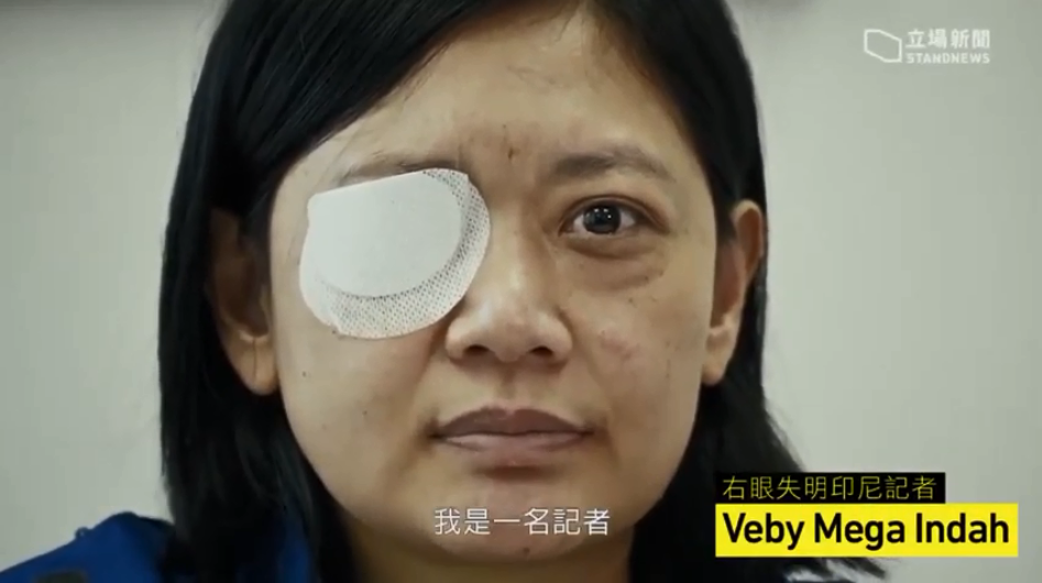 印尼女記者英達(Veby Mega Indah)在香港報導反送中抗爭期間，遭港警發射疑似橡膠子彈擊中右眼失明。(翻攝自立場新聞)