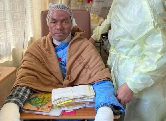 反送中縱火燒人事件 傷者病情已好轉(圖取自葛珮帆臉書)
