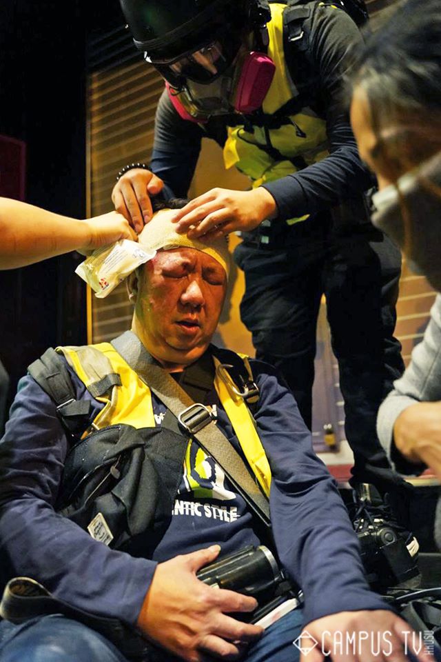 一名星島日報記者被胡椒球彈擊中頭部，額頭流血，(臉書)