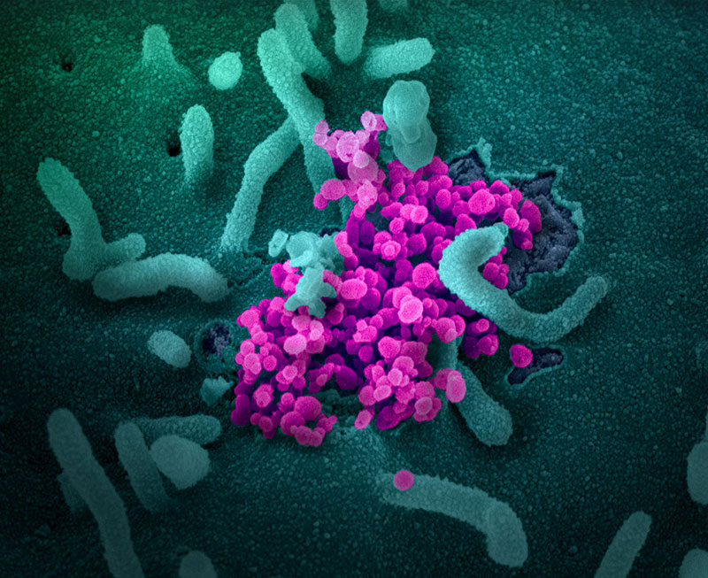 2019新型冠狀病毒（照片中桃紅色顆粒） 圖：NIAID-RML