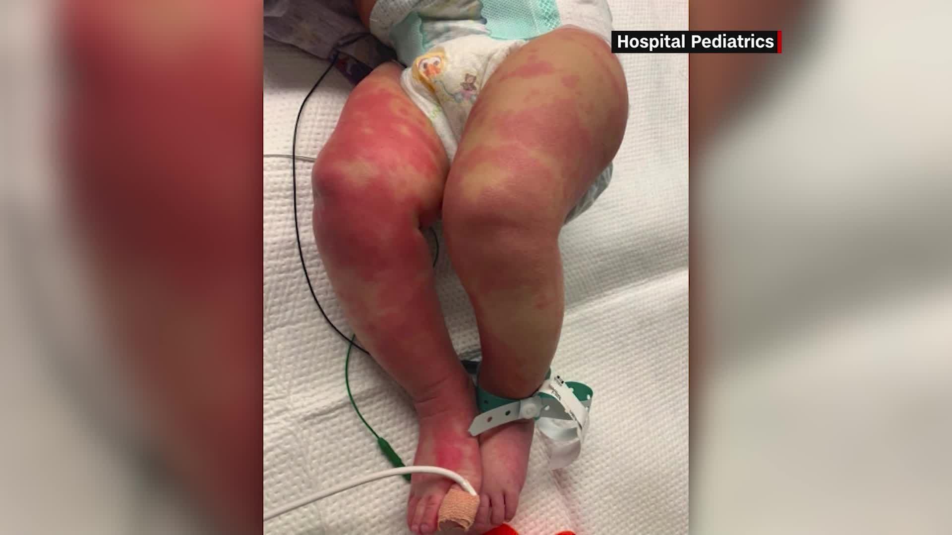 美國衛生當局14日發出警告，表示有一種好發在兒童身上、罕見卻可能致命的自體免疫症狀，據信與COVID-19有關。(圖/推特)