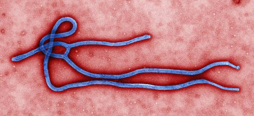 伊波拉(Ebola)病毒再度現蹤。(圖: CDC)
