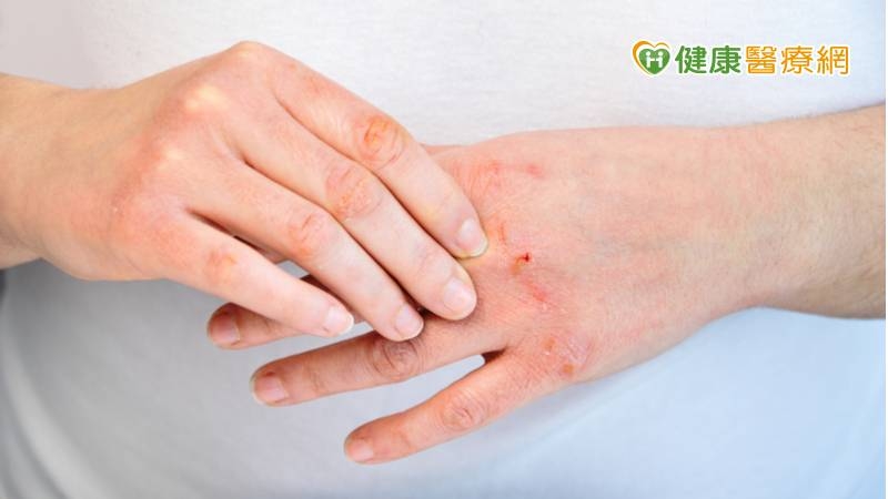 想要維持手部肌膚柔嫩，可留意洗手時的水溫、塗抹護手霜、適度去角質、防曬、讓手部休息及補充水分等方式來保護雙手。(圖：健康醫療網 提供)