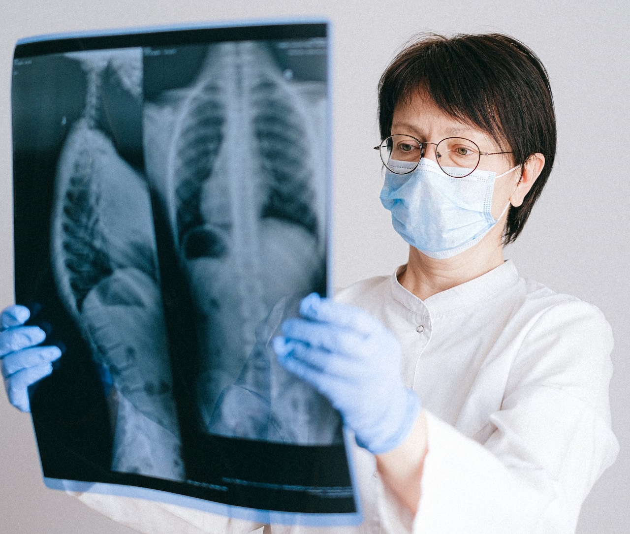 國健署日前公布最新癌症登記報告，肺癌首度躍升第1，擠下蟬聯15年榜首的大腸癌。(圖：pexels)
