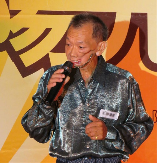 舞台上的阿德大哥